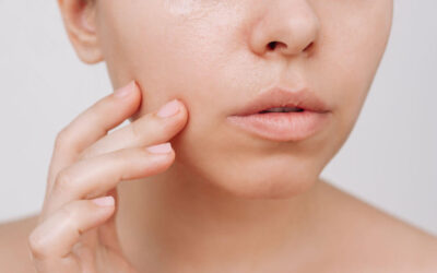 Tipos de Piel: Grasa, Seca y Mixta. Productos y Recomendaciones para Cuidarlas
